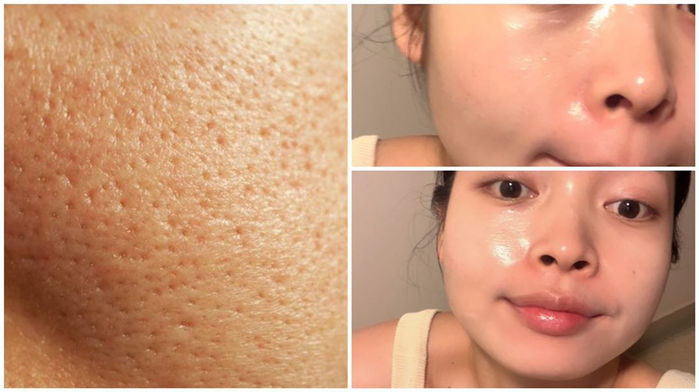 Công cuộc se khít lỗ chân lông sẽ dễ ợt chỉ với 3 sản phẩm “ruột