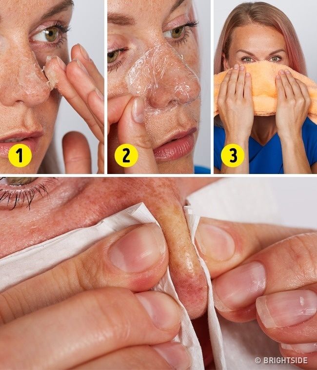 Uốn mi cong hơn nhờ máy sấy, làm sạch mụn cám với vaseline