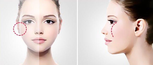 Nhân tướng học: Mũi hếch, 1 trong 5 nét tướng của phụ nữ khổ vì tình