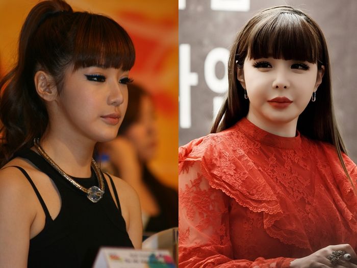 Sao thế giới nhận trái đắng vì dao kéo: Trịnh Sảng lệch cả mặt