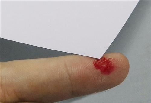 Những nỗi sợ kỳ lạ khiến nhiều người nổi da gà, nhất là cái đầu tiên