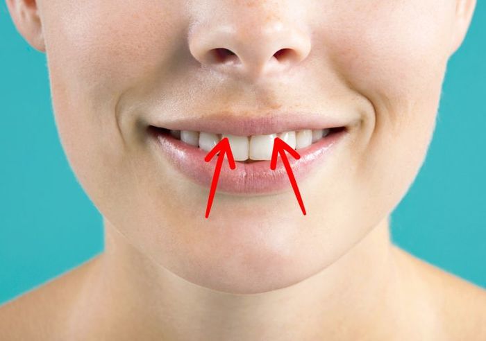 13 mẹo chữa bệnh không dùng thuốc: chườm đá vào bàn tay chữa đau răng