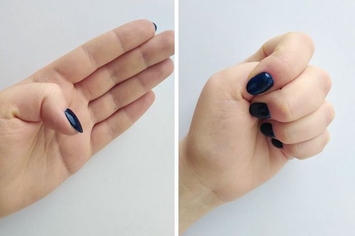 13 mẹo chữa bệnh không dùng thuốc: chườm đá vào bàn tay chữa đau răng