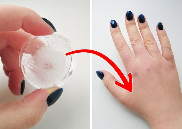 13 mẹo chữa bệnh không dùng thuốc: chườm đá vào bàn tay chữa đau răng