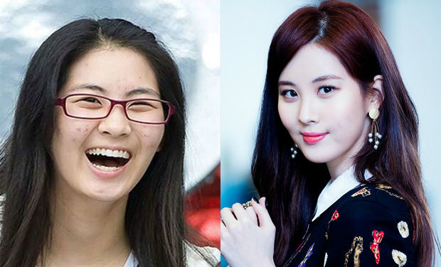 Rời xa son phấn: Seolhyun, Chanyeol da sần sùi lấm tấm mụn