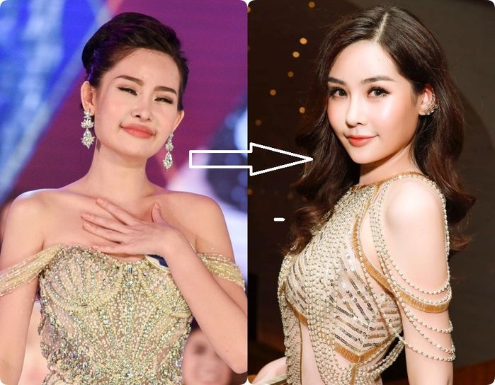 3 năm sau đăng quang, Hoa hậu môi tều” Lê Âu Ngân Anh khác lạ hẳn