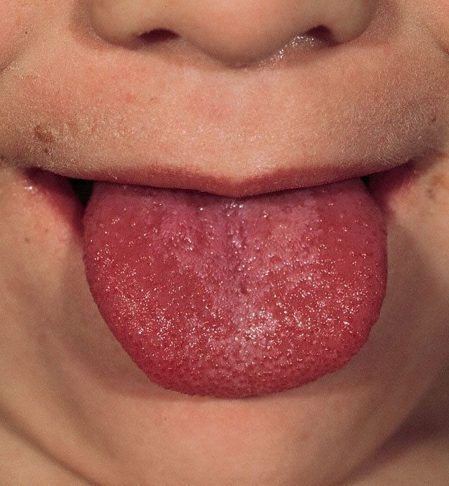 8 bí mật về chiếc lưỡi: có thể cuộn thành hình chữ U hay cỏ ba lá