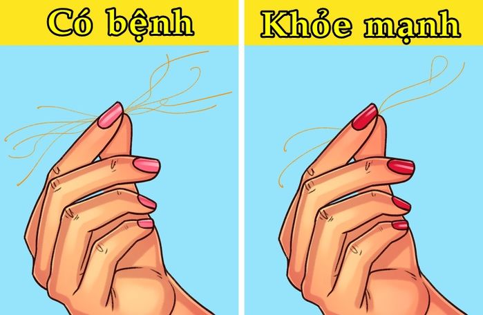9 mẹo kiểm tra sức khỏe ngay tại nhà cho những người lười đi khám