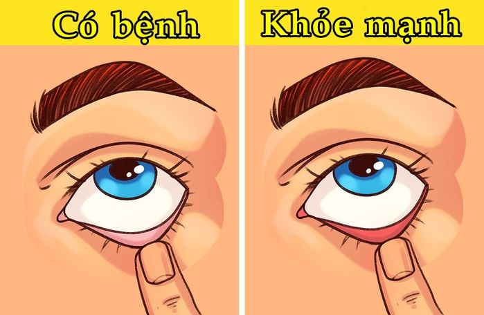 9 mẹo kiểm tra sức khỏe ngay tại nhà cho những người lười đi khám