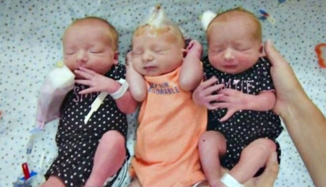 Đi khám vì nghi sỏi thận, người phụ nữ sững sờ nhận ra mình sắp sinh 3