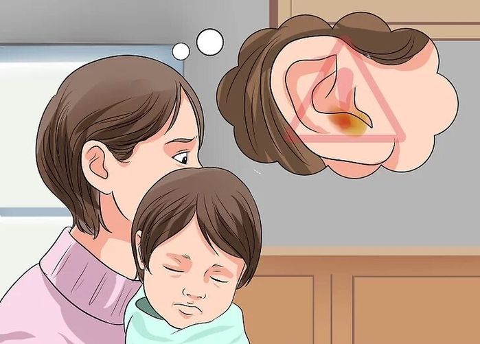 Dấu hiệu nhận biết trẻ có nguy cơ mắc bệnh viêm tai giữa