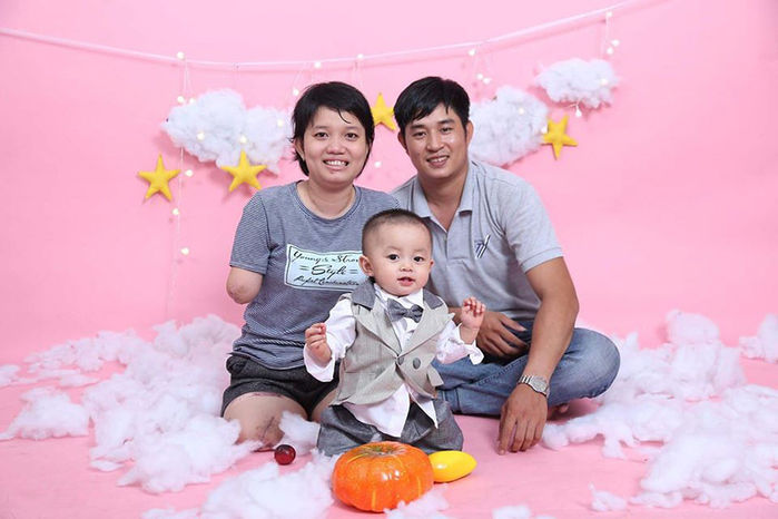 Mẹ trẻ mất tứ chi vì nhiễm trùng huyết sau sinh, bác sĩ lưu ý dấu hiệu
