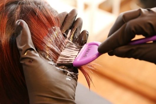 Nhuộm tóc suốt 16 năm chàng trai 36 tuổi suy sụp khi BS chẩn đoán bệnh