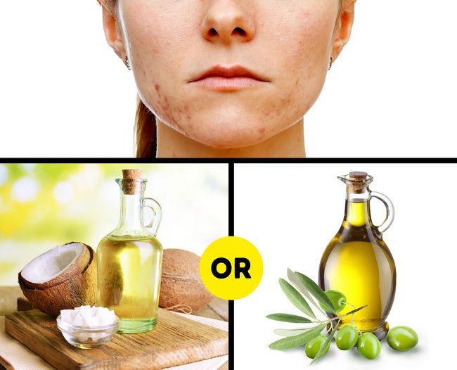 10 cách làm cho sẹo lâu năm ''một đi không trở lại''