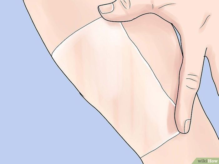 10 cách làm cho sẹo lâu năm ''một đi không trở lại''