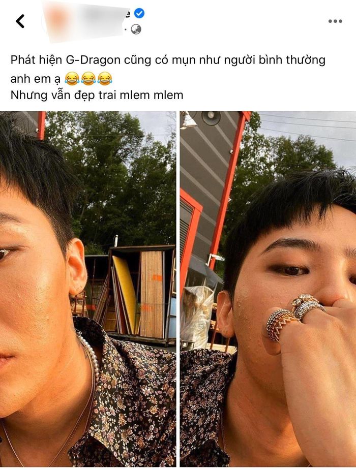 Đẳng cấp ông hoàng K-pop G-Dragon: có mụn mà vẫn gây sốt