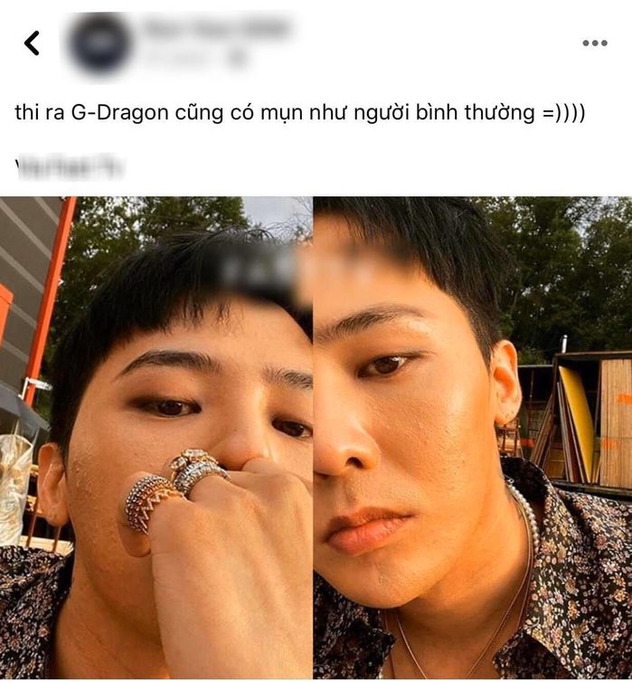 Đẳng cấp ông hoàng K-pop G-Dragon: có mụn mà vẫn gây sốt
