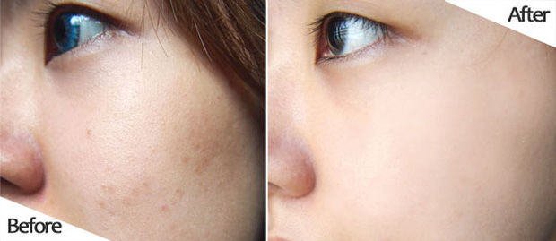 4 loại serum giúp người Nhật trị tận gốc nám, cho da trắng hồng