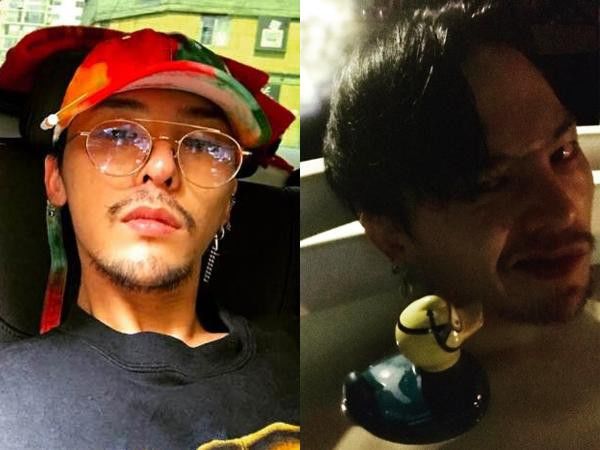 Đẳng cấp ông hoàng K-pop G-Dragon: có mụn mà vẫn gây sốt