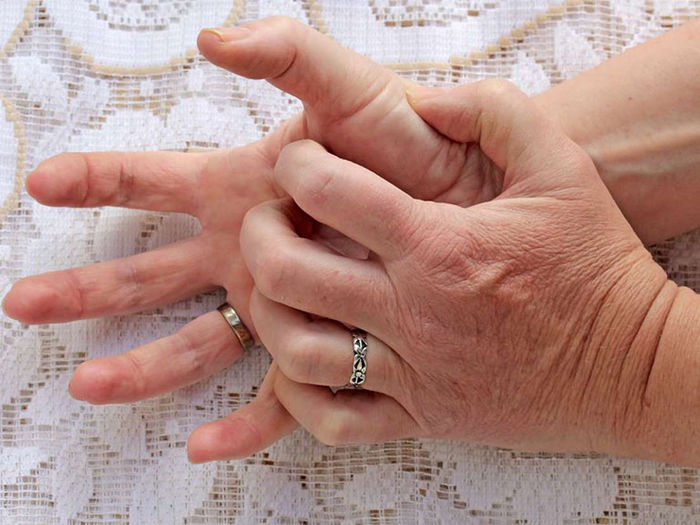 6 nguyên nhân khiến lòng bàn tay của bạn ngứa ran