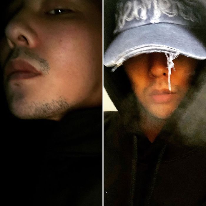 Đẳng cấp ông hoàng K-pop G-Dragon: có mụn mà vẫn gây sốt