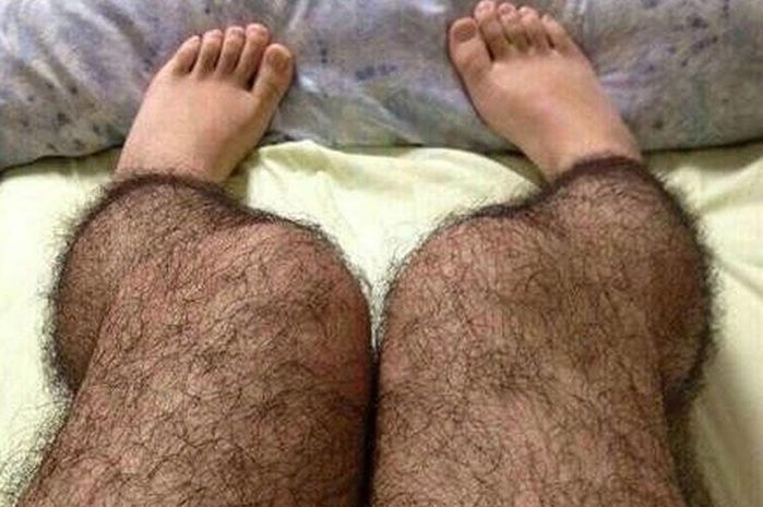 Căn bệnh lạ xuất hiện đầu tiên ở Việt Nam, cả thế giới chỉ có 74 ca
