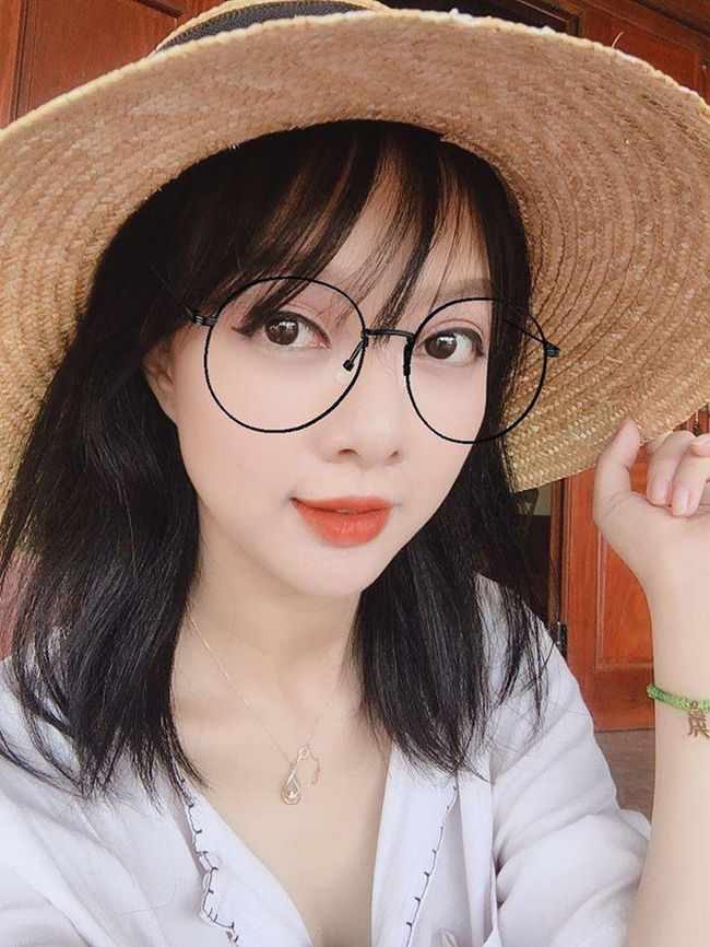 MC xinh đẹp của VTV bị đục thủy tinh thể, nguy cơ mù khá cao