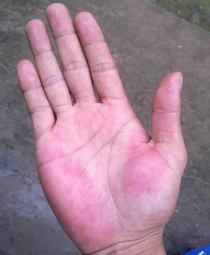 Có 4 dấu hiệu trên bàn tay ngầm báo bạn sắp trúng số, sẽ giàu to