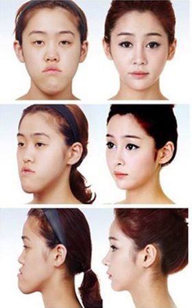 Cô gái Hàn Quốc sau 8 năm dao kéo: công việc, tình yêu đều thuận lợi
