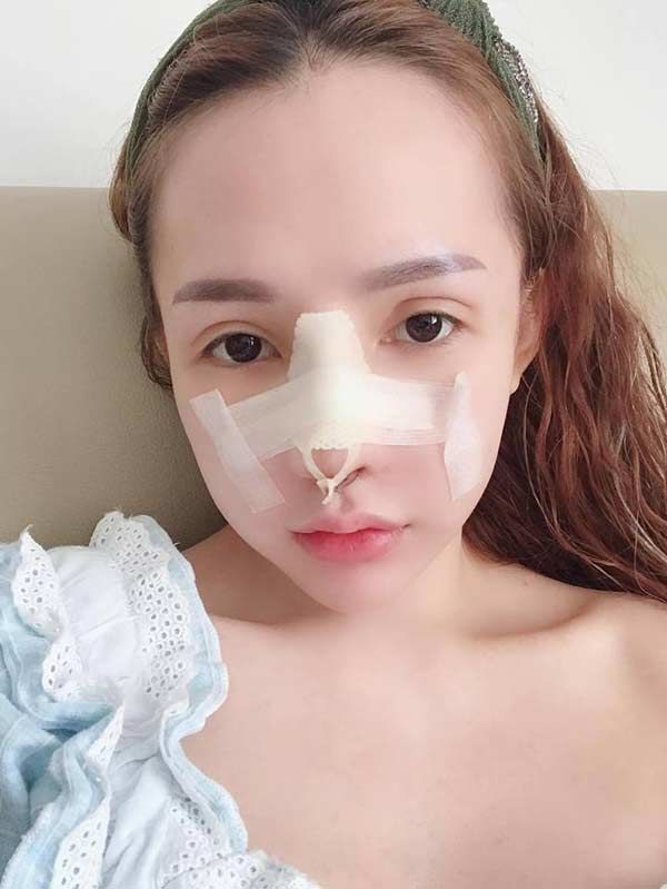 Chi 400 triệu VND thẩm mỹ, cô gái Sài Gòn tiết lộ không dám mang bầu