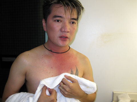 Dương Triệu Vũ nhắc lại vụ Đàm Vĩnh Hưng bị xịt hơi cay trên sân khấu