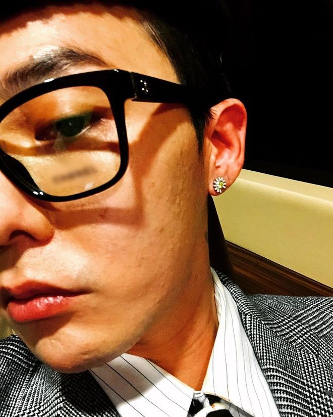Đẳng cấp ông hoàng K-pop G-Dragon: có mụn mà vẫn gây sốt
