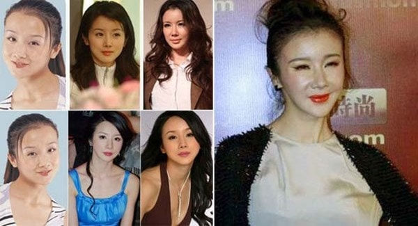 Đệ nhất mỹ nhân cổ trang lộ gương mặt biến dạng vì nghiện thẩm mỹ