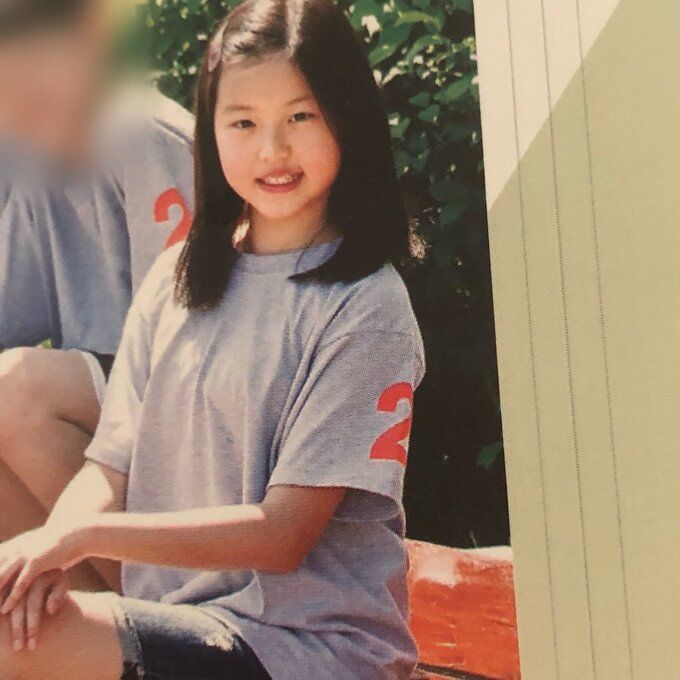 Lộ ảnh quá khứ, Jang Won Young bị nghi động chạm dao kéo