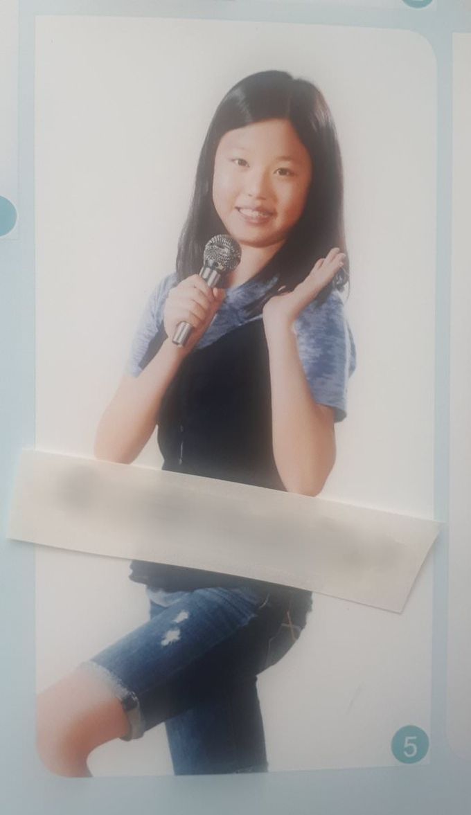 Lộ ảnh quá khứ, Jang Won Young bị nghi động chạm dao kéo