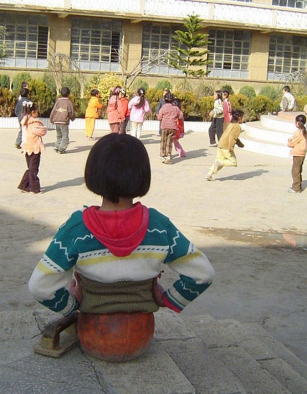 Dùng bóng rổ làm chân, cô gái nỗ lực trở thành kình ngư bơi lội