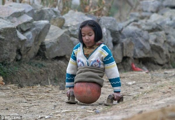 Dùng bóng rổ làm chân, cô gái nỗ lực trở thành kình ngư bơi lội