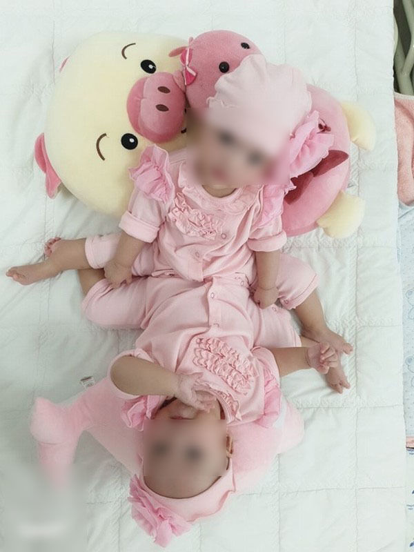 Hình siêu âm của cặp song sinh được công bố, CĐM vô cùng xúc động