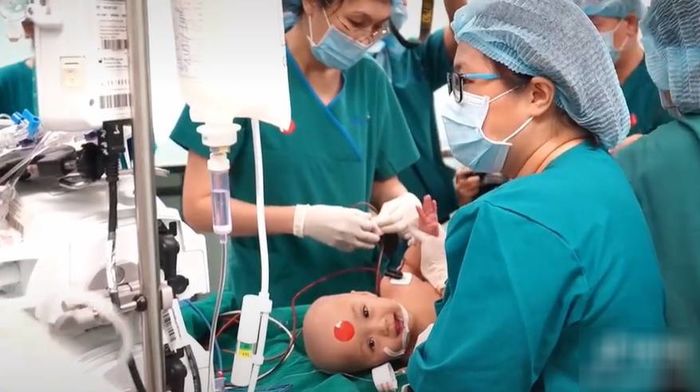 Khoảnh khắc gây mê trước khi vào phòng mổ của cặp song sinh dính liền