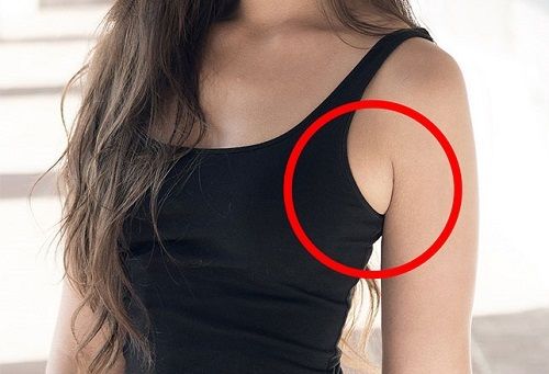 Mỡ vùng nách “dìm hàng” mỹ nhân: Đến Hà Anh, Minh Tú cũng “bớt duyên”