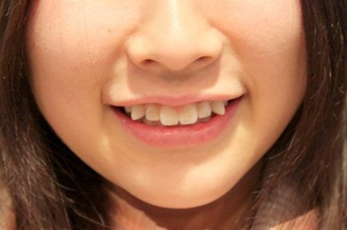 Nhân tướng học: Nhìn tướng răng biết ngay ai sướng, ai khổ cả đời