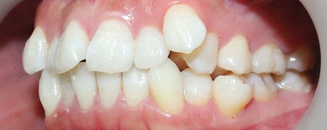 Nhân tướng học: Nhìn tướng răng biết ngay ai sướng, ai khổ cả đời