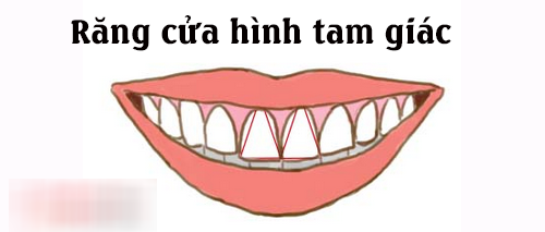 Nhân tướng học: Tướng răng cửa tiết lộ bản chất tốt xấu của một người