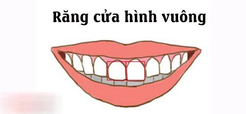 Nhân tướng học: Tướng răng cửa tiết lộ bản chất tốt xấu của một người