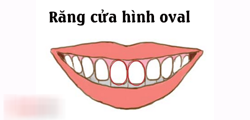 Nhân tướng học: Tướng răng cửa tiết lộ bản chất tốt xấu của một người