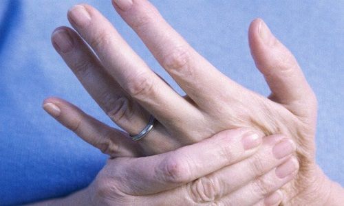 Dấu hiệu tay cho biết nguy cơ mắc bệnh của dạ dày: Lòng tay đỏ rát