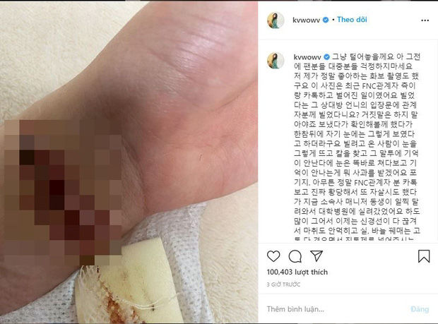 Mina đăng trạng thái tiêu cực, thể hiện sự phẫn nộ với Jimin, Seolhyun