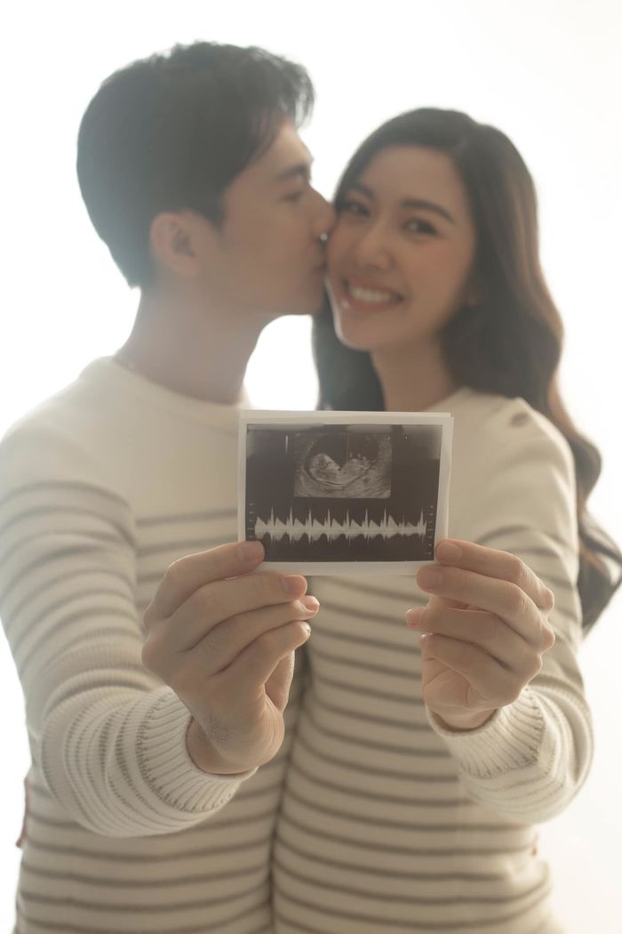 Á hậu Thúy Vân hạnh phúc cùng chồng khoe ảnh lần đầu siêu âm