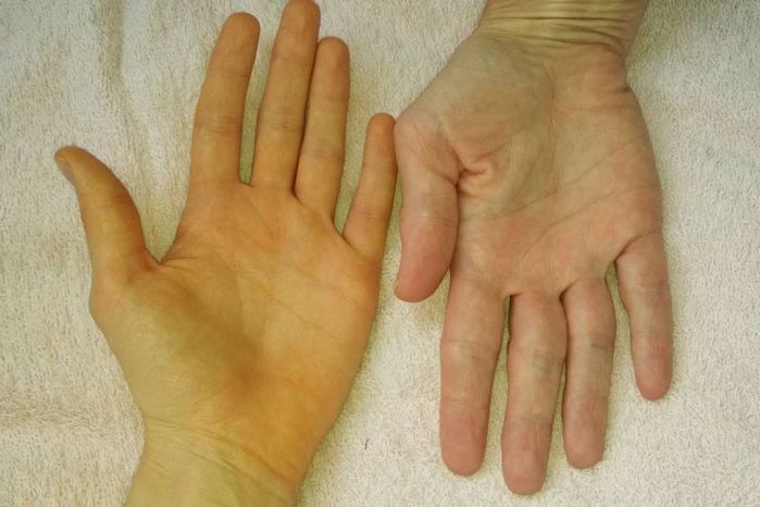 3 thói quen vào mỗi sáng sớm thức dậy giúp bảo vệ lá gan khỏe mạnh
