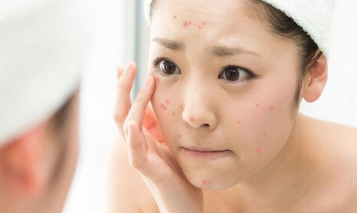 Ăn cay ngon miệng nhưng người đau dạ dày, huyết áp cao... nên kiêng